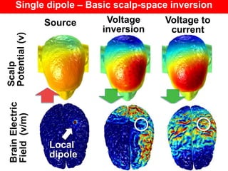 Single dipole – Basic scalp-space inversion
Scalp
Potential(v)
BrainElectric
Field(v/m)
Local
dipole
Source Voltage
inversion
Voltage to
current
 