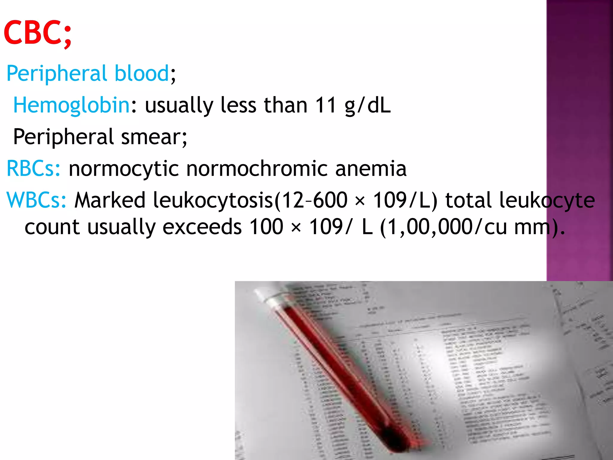 Peripheral blood;
Hemoglobin: usually less than 11 g/dL
Peripheral smear;
RBCs: normocytic normochromic anemia
WBCs: Marked leukocytosis(12–600 × 109/L) total leukocyte
count usually exceeds 100 × 109/ L (1,00,000/cu mm).
 
