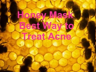 Honey Mask  Best Way to Treat Acne 