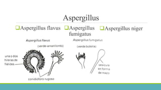 Aspergillus 
Aspergillus flavus Aspergillus 
fumigatus 
Aspergillus niger 
 