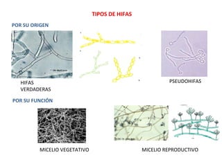TIPOS DE HIFAS
HIFAS
VERDADERAS
PSEUDOHIFAS
POR SU ORIGEN
POR SU FUNCIÓN
MICELIO VEGETATIVO MICELIO REPRODUCTIVO
 