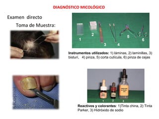 DIAGNÓSTICO MICOLÓGICO
Examen directo
Toma de Muestra:
Instrumentos utilizados: 1) láminas, 2) laminillas, 3)
bisturí, 4) pinza, 5) corta cutícula, 6) pinza de cejas
Reactivos y colorantes: 1)Tinta china, 2) Tinta
Parker, 3) Hidróxido de sodio
 