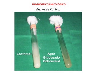 Medios de Cultivo:
DIAGNÓSTICOS MICOLÓGICO
 