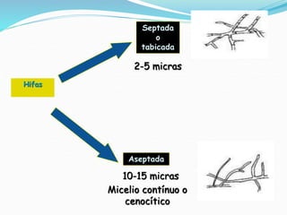 Hifas
Septada
o
tabicada
Aseptada
Micelio contínuo o
cenocítico
2-5 micras
10-15 micras
 