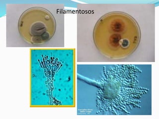 Filamentosos
 