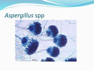 Aspergillus spp
 