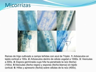 Micorrizas
Raíces de trigo cultivado a campo teñidas con azul de Tripán. 1: Arbúsculos en
tejido cortical a 100x. 2: Arbúsculos dentro de célula vegetal a 1000x. 3: Vesículas
a 400x. 4: Espora germinada cuya hifa ha penetrado la raíz (fecha)
(100x). 5:Vesículas (fecha negra) y esporas (fecha blanca) en tejido
cortical. 6: Hifas y apresorio (fecha) sobre células de la raíz (400x).
 