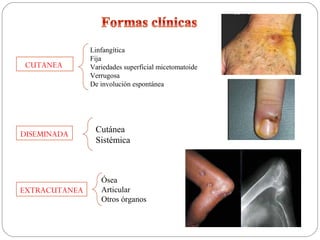 Linfangítica
               Fija
CUTANEA        Variedades superficial micetomatoide
               Verrugosa
               De involución espontánea




DISEMINADA      Cutánea
                Sistémica



                  Ósea
EXTRACUTANEA      Articular
                  Otros órganos
 