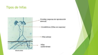 Tipos de hifas
 