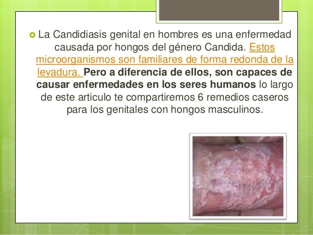 El tratamiento contra la caída de los cabello y la fragilidad de las uñas