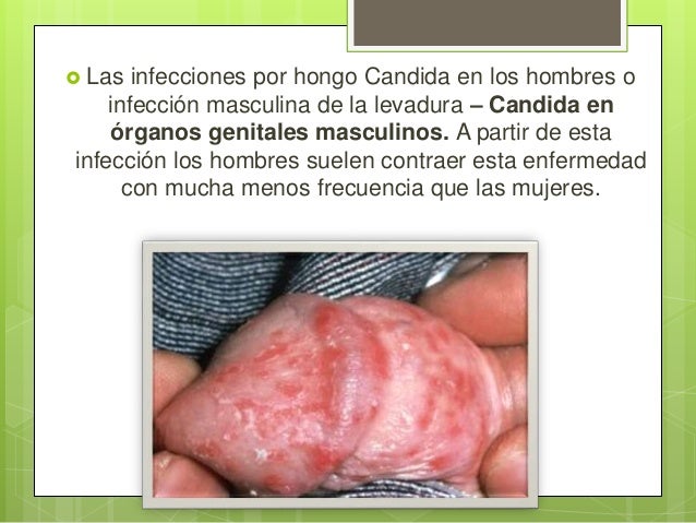 El medio medicinal el hongo
