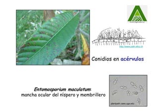 Entomosporium maculatum:
mancha ocular del níspero y membrillero
http://www.path.ethz.ch
Conidios en acérvulos
plantpath.caes.uga.edu
 