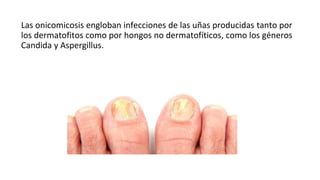Las onicomicosis engloban infecciones de las uñas producidas tanto por
los dermatofitos como por hongos no dermatofíticos, como los géneros
Candida y Aspergillus.
 