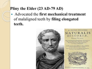 Pliny the Elder (23 AD-79 AD)
 Advocated the first mechanical treatment
of malaligned teeth by filing elongated
teeth.
 