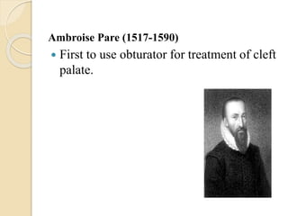 Ambroise Pare (1517-1590)
 First to use obturator for treatment of cleft
palate.
 