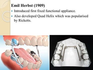 Emil Herbst (1909)
 Introduced first fixed functional appliance.
 Also developed Quad Helix which was popularised
by Ricketts.
 