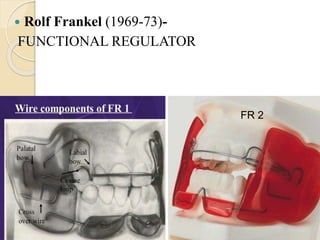  Rolf Frankel (1969-73)-
FUNCTIONAL REGULATOR
FR 2
 