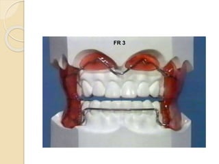 FR 3
 