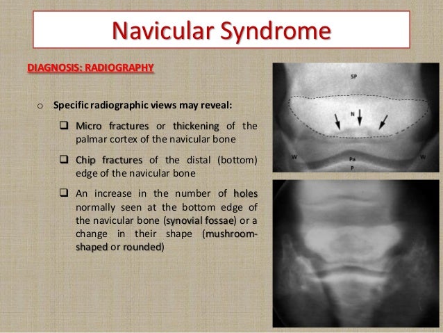 lameness (equine hoof affections) Dr. Alaa Ghazy