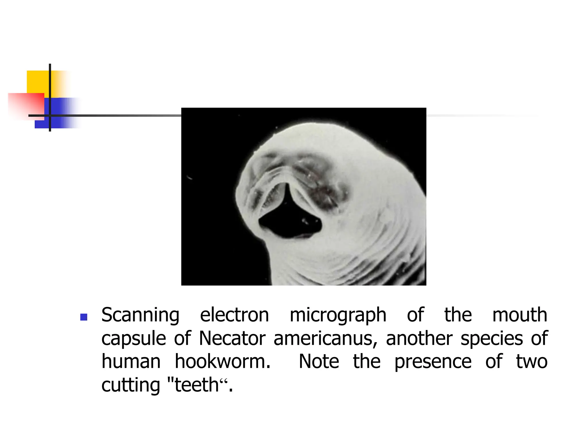 Scanning electron micrograph of the mouth
capsule of Necator americanus, another species of
human hookworm. Note the presence of two
cutting "teeth“.
 