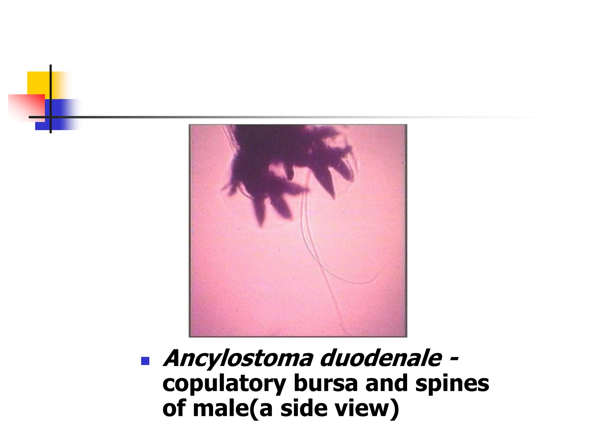  Ancylostoma duodenale -
copulatory bursa and spines
of male(a side view)
 