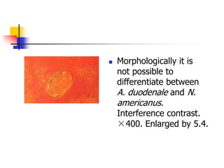  Morphologically it is
not possible to
differentiate between
A. duodenale and N.
americanus.
Interference contrast.
×400. Enlarged by 5.4.
 