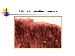 Adults in intestinal mucosa
 