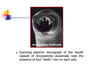  Scanning electron micrograph of the mouth
capsule of Ancylostoma duodenale, note the
presence of four "teeth," two on each side.
 