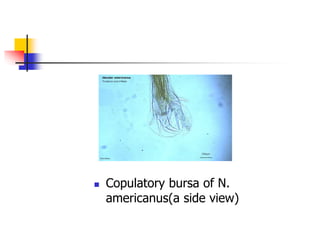  Copulatory bursa of N.
americanus(a side view)
 