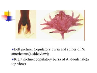 Left picture: Copulatory bursa and spines of N.
americanus(a side view);
Right picture: copulatory bursa of A. duodenale(a
top view)
 