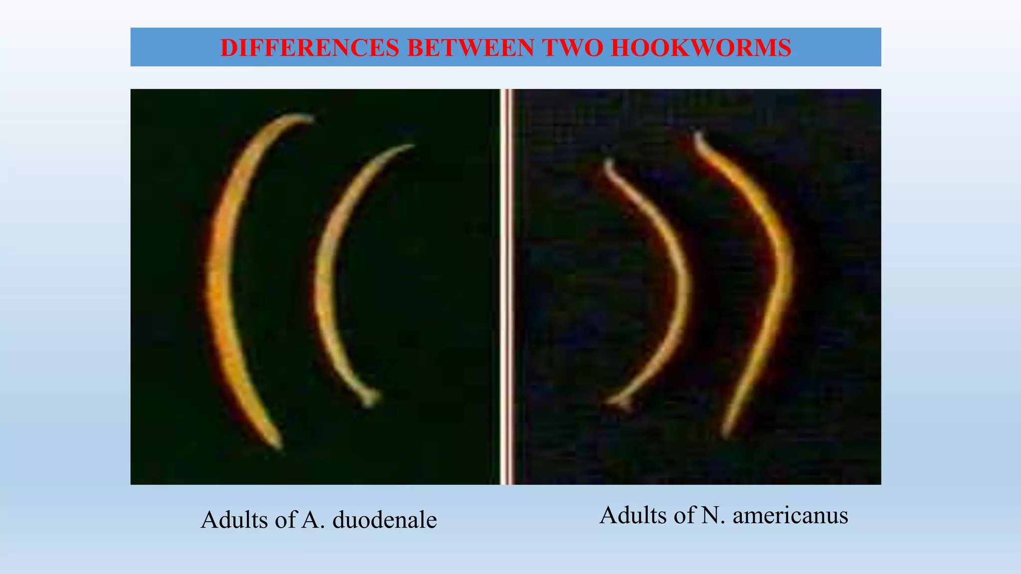 Adults of A. duodenale Adults of N. americanus
DIFFERENCES BETWEEN TWO HOOKWORMS
 