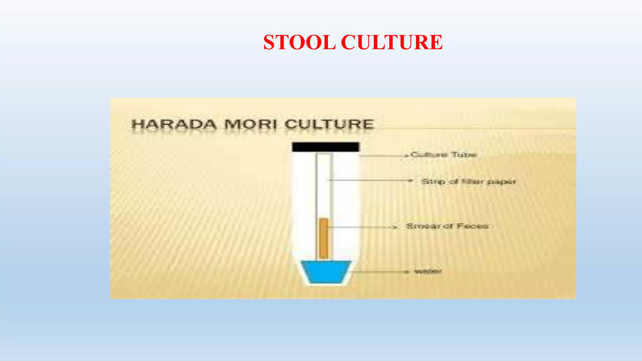 STOOL CULTURE
 