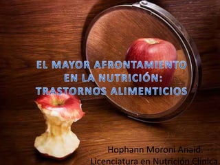 Hophann Moroni Anaid.
Licenciatura en Nutrición Clínica.

 