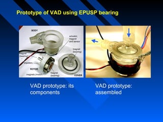 Prototype of VAD using EPUSP bearing

BODY
actuator,
magnet
and sensor
magnet
(bearing)

magnet
(bearing)
impellers
ROTOR
magnets (motor)

magnet
(bearing)

VAD prototype: its
components

COVER

VAD prototype:
assembled

 