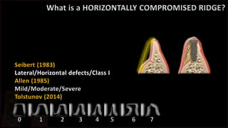 Horizintal ridge augmentations worth or vain | PPTX
