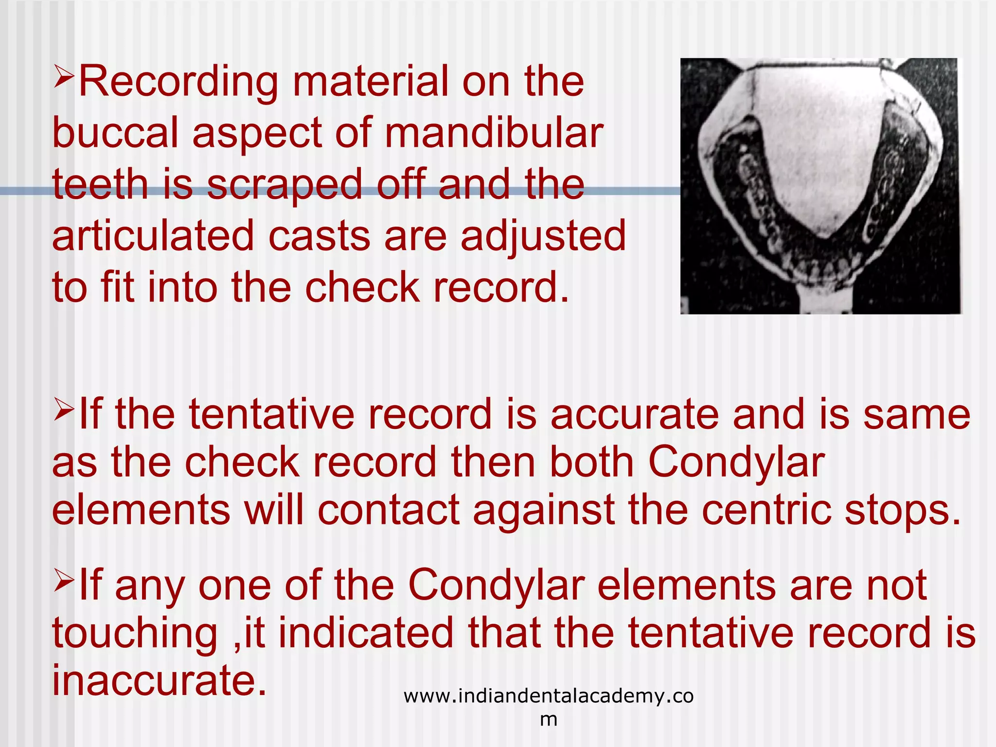Recording

material on the
buccal aspect of mandibular
teeth is scraped off and the
articulated casts are adjusted
to fit into the check record.
If

the tentative record is accurate and is same
as the check record then both Condylar
elements will contact against the centric stops.
If

any one of the Condylar elements are not
touching ,it indicated that the tentative record is
inaccurate.
www.indiandentalacademy.co
m

 