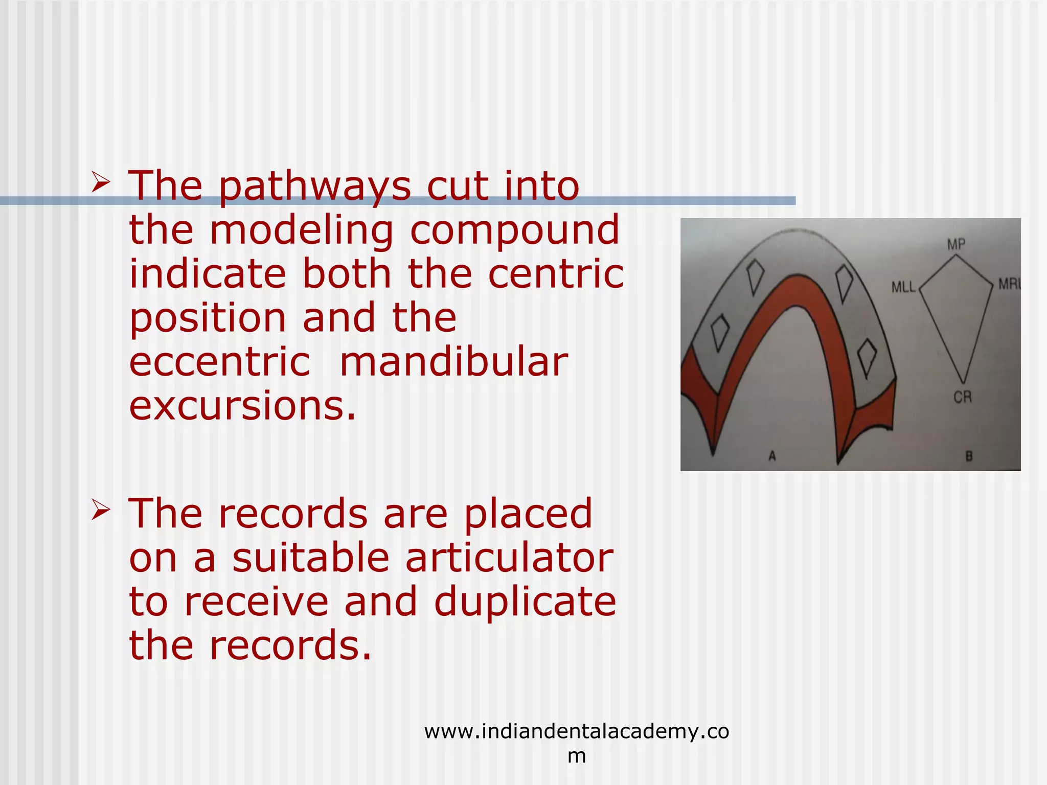 

The pathways cut into
the modeling compound
indicate both the centric
position and the
eccentric mandibular
excursions.



The records are placed
on a suitable articulator
to receive and duplicate
the records.
www.indiandentalacademy.co
m

 