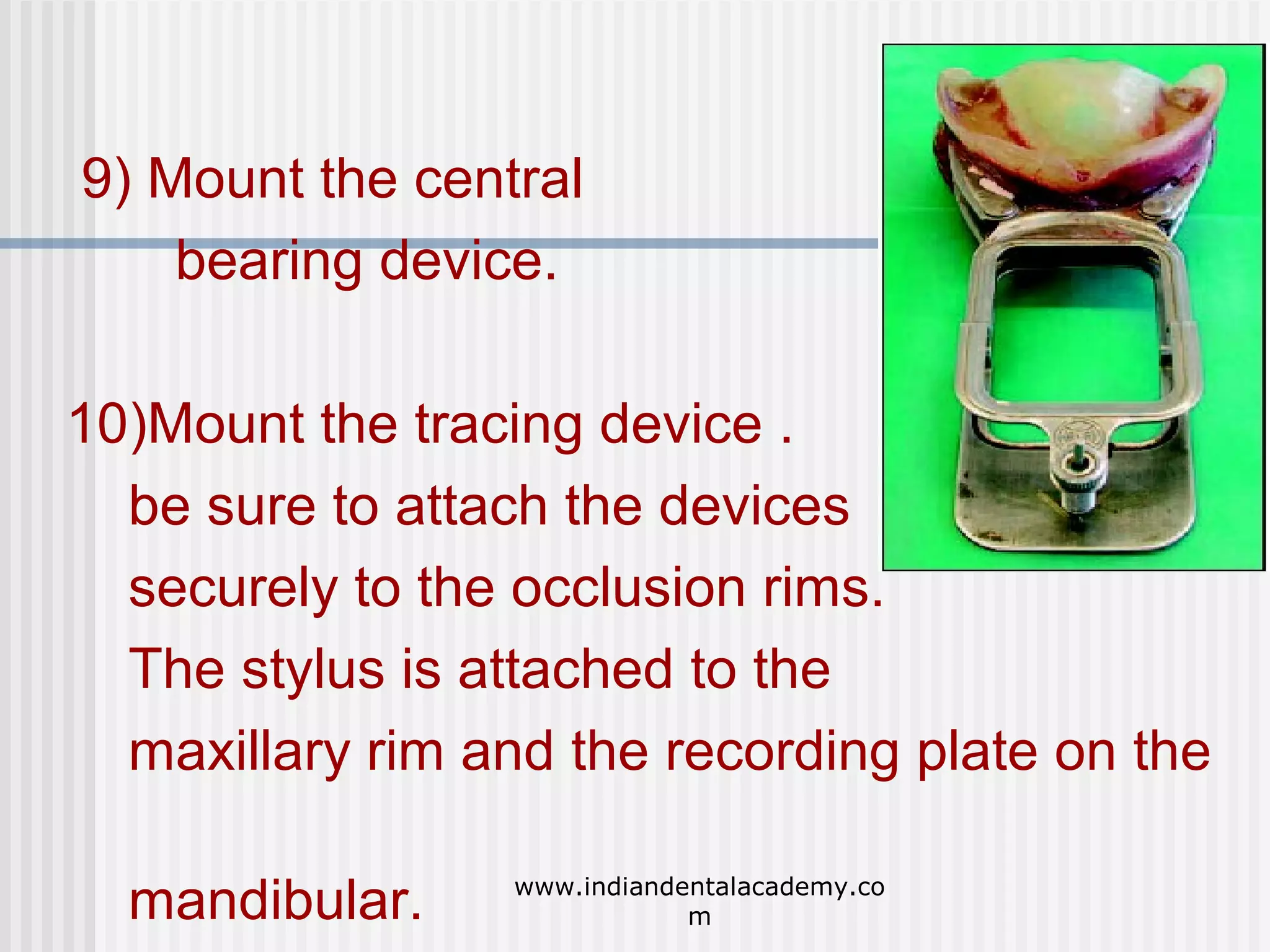 9) Mount the central
bearing device.
10)Mount the tracing device .
be sure to attach the devices
securely to the occlusion rims.
The stylus is attached to the
maxillary rim and the recording plate on the
mandibular.

www.indiandentalacademy.co
m

 