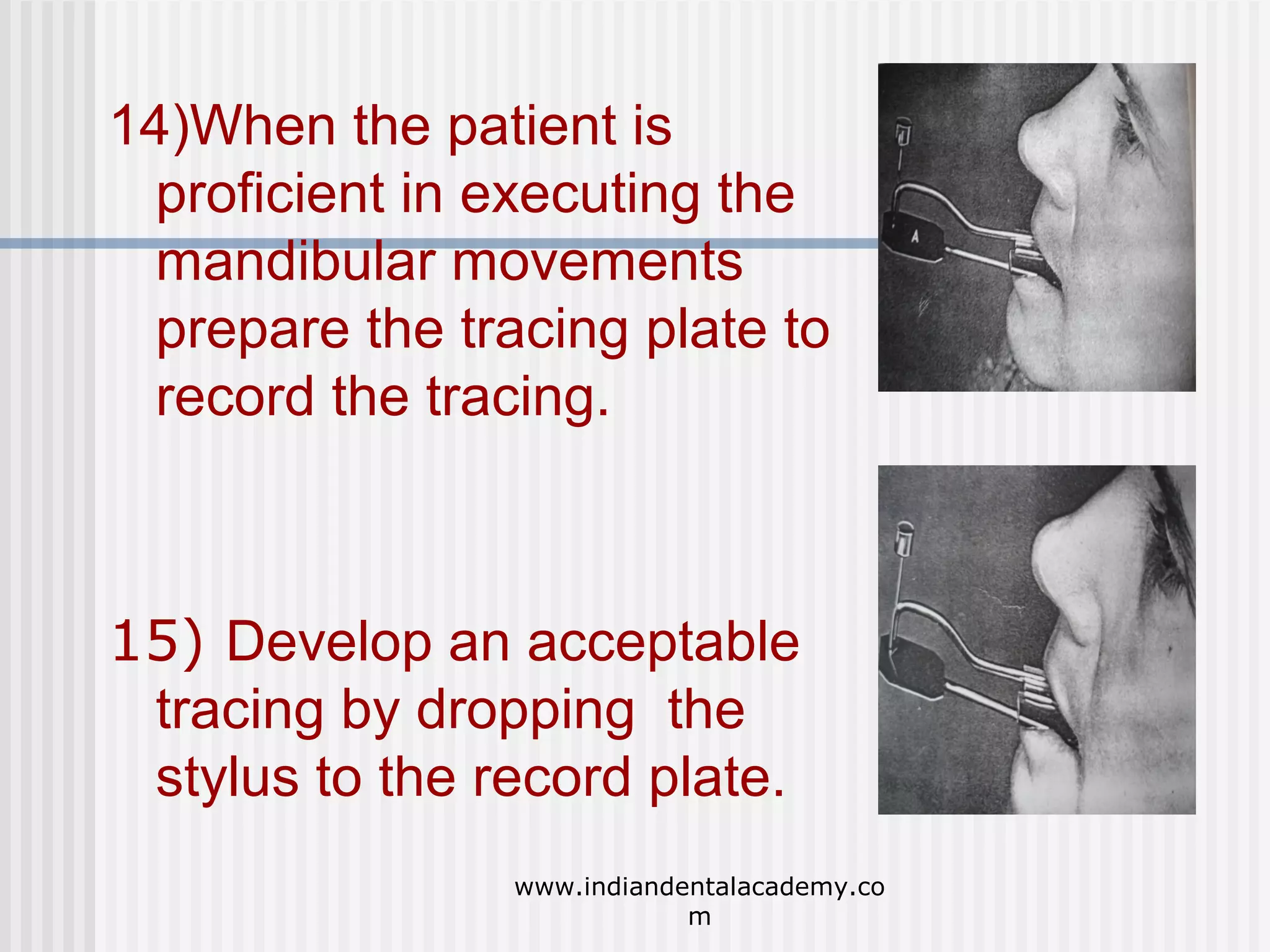 14)When the patient is
proficient in executing the
mandibular movements
prepare the tracing plate to
record the tracing.

15) Develop an acceptable
tracing by dropping the
stylus to the record plate.
www.indiandentalacademy.co
m

 