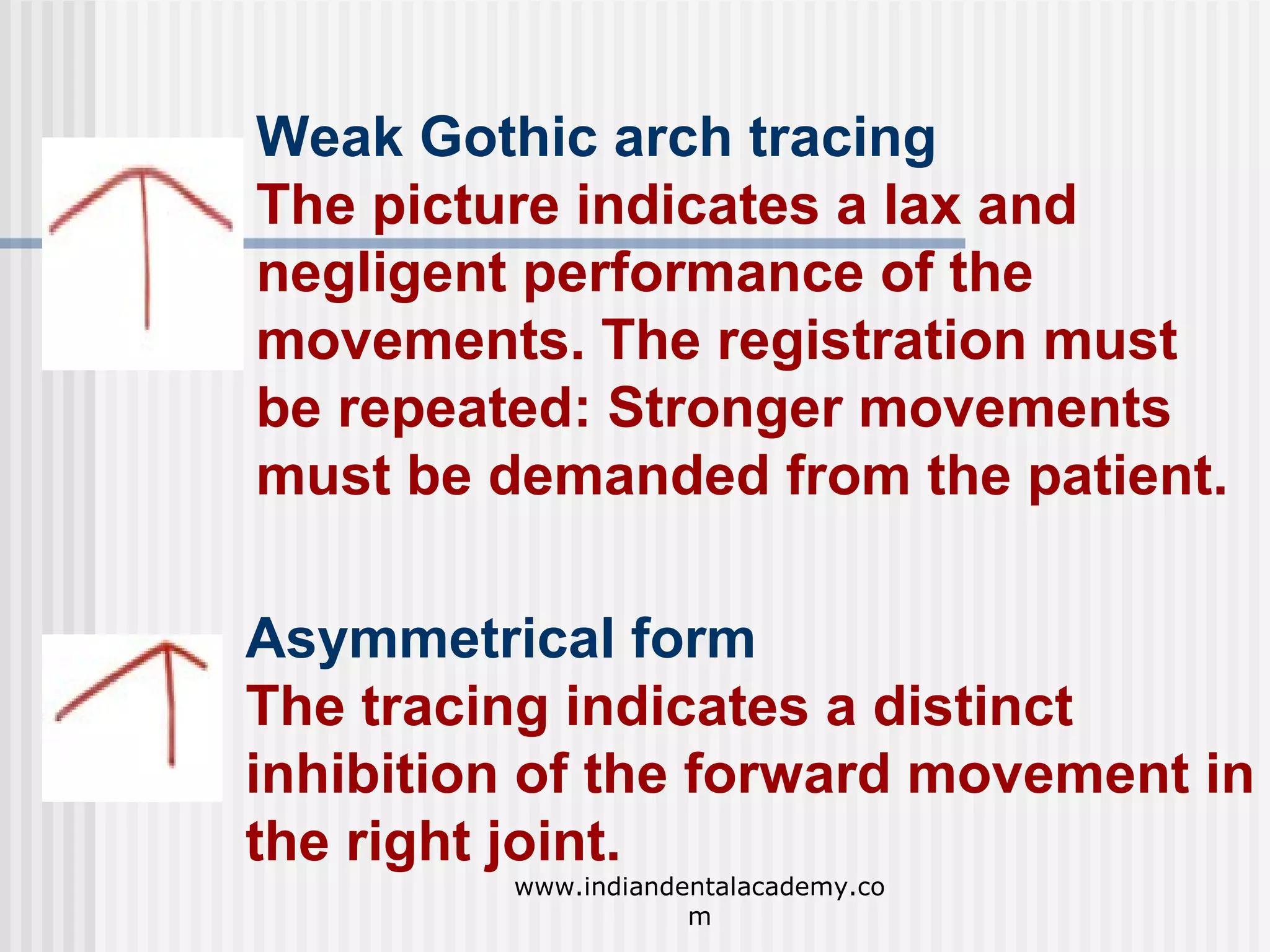 Weak Gothic arch tracing
The picture indicates a lax and
negligent performance of the
movements. The registration must
be repeated: Stronger movements
must be demanded from the patient.
Asymmetrical form
The tracing indicates a distinct
inhibition of the forward movement in
the right joint.
www.indiandentalacademy.co
m

 