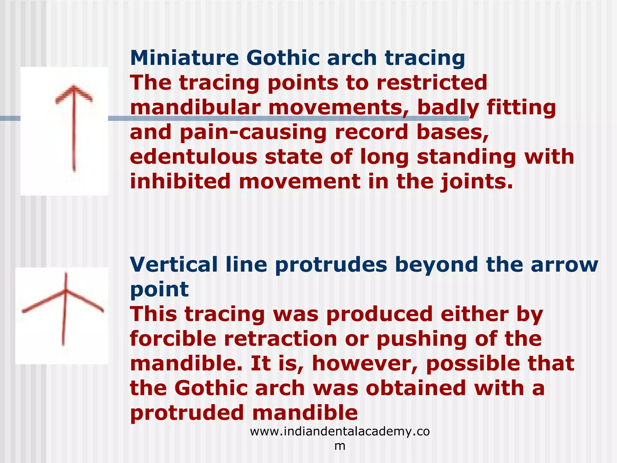 Miniature Gothic arch tracing
The tracing points to restricted
mandibular movements, badly fitting
and pain-causing record bases,
edentulous state of long standing with
inhibited movement in the joints.

Vertical line protrudes beyond the arrow
point
This tracing was produced either by
forcible retraction or pushing of the
mandible. It is, however, possible that
the Gothic arch was obtained with a
protruded mandible
www.indiandentalacademy.co
m

 
