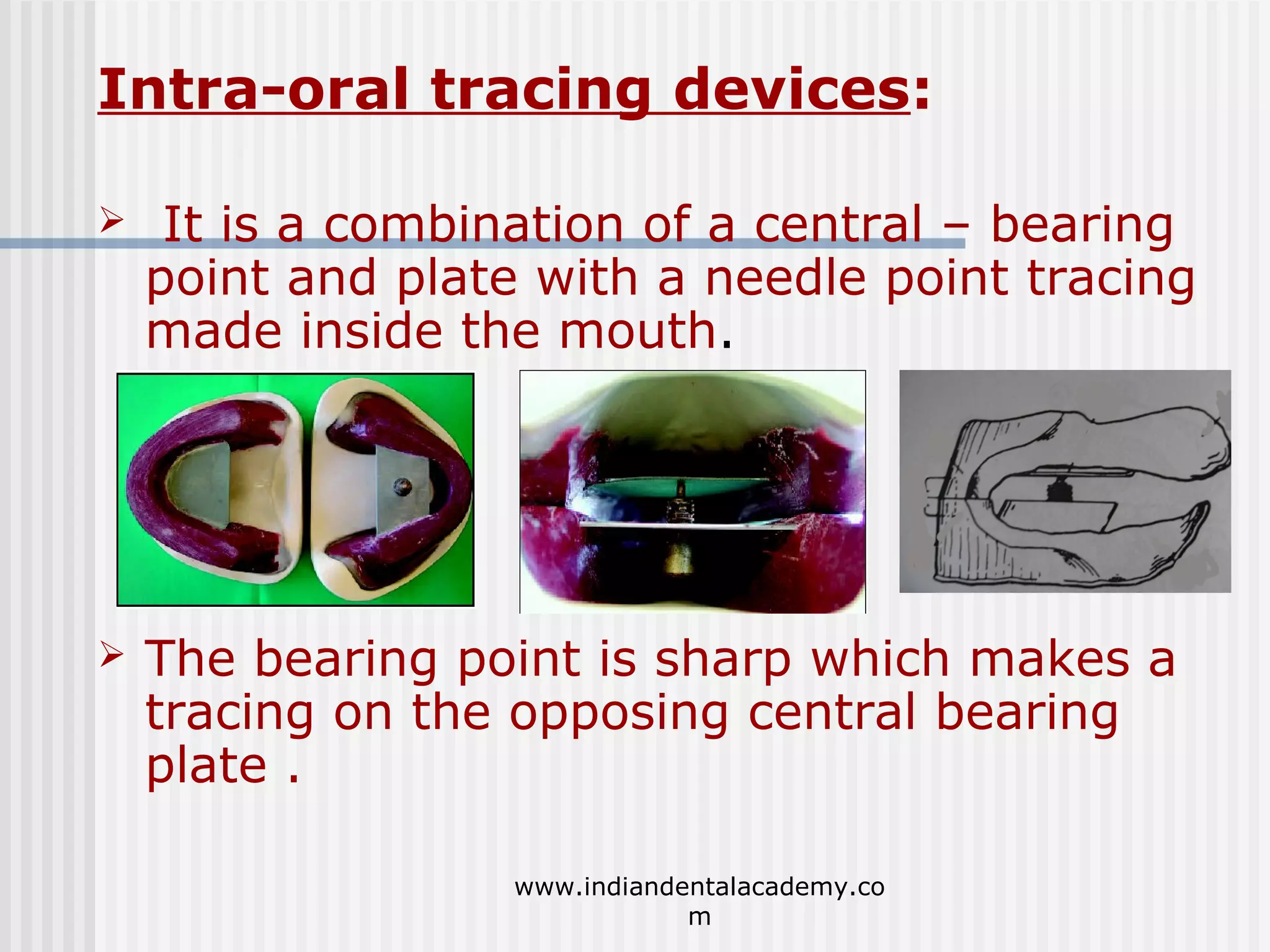 Intra-oral tracing devices:


It is a combination of a central – bearing
point and plate with a needle point tracing
made inside the mouth.



The bearing point is sharp which makes a
tracing on the opposing central bearing
plate .
www.indiandentalacademy.co
m

 