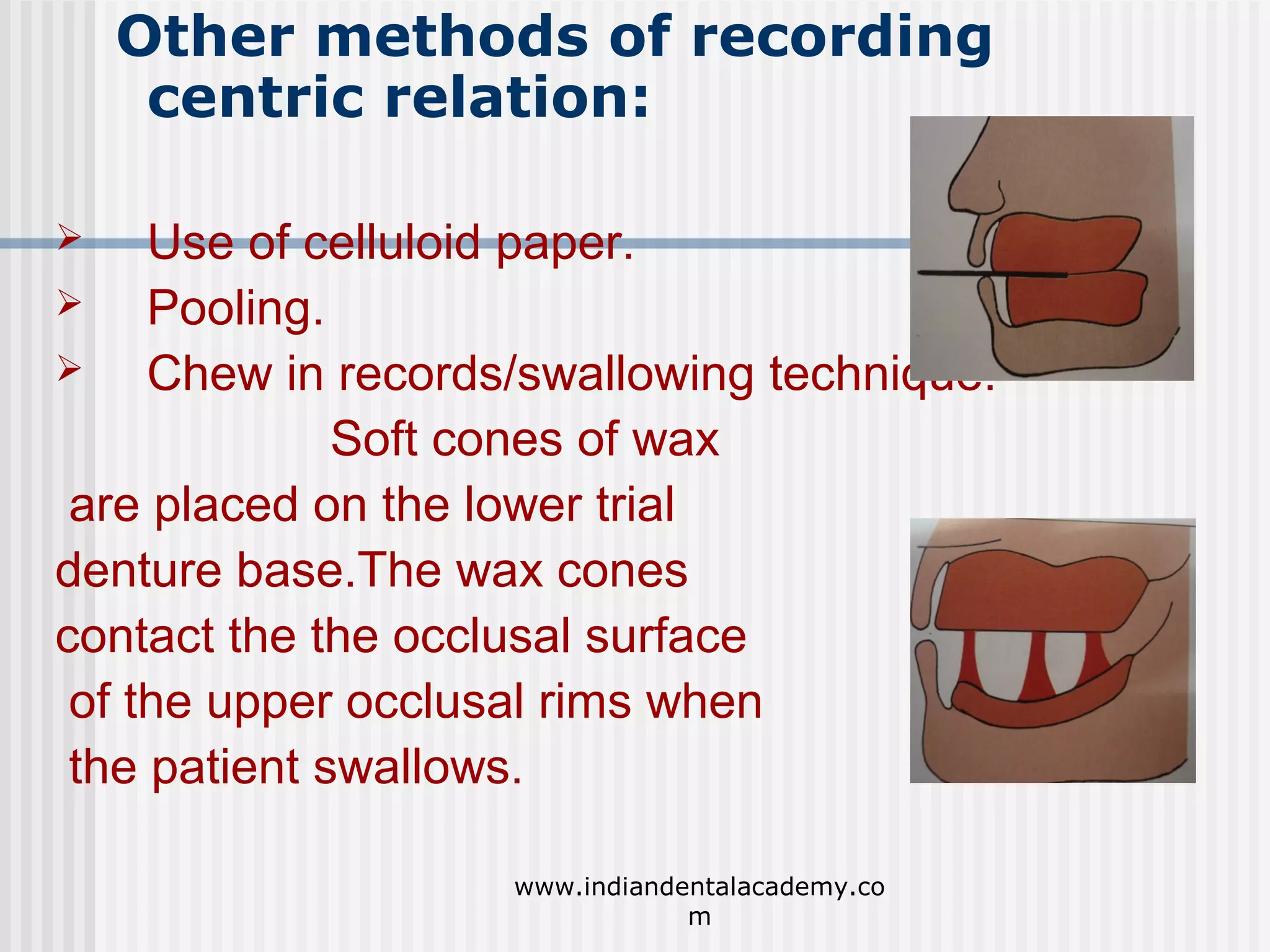 Other methods of recording
centric relation:
Use of celluloid paper.

Pooling.

Chew in records/swallowing technique:
Soft cones of wax
are placed on the lower trial
denture base.The wax cones
contact the the occlusal surface
of the upper occlusal rims when
the patient swallows.


www.indiandentalacademy.co
m

 