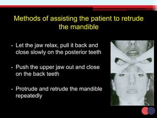 Methods of assisting the patient to retrude
the mandible
• Let the jaw relax, pull it back and
close slowly on the posterior teeth
• Push the upper jaw out and close
on the back teeth
• Protrude and retrude the mandible
repeatedly
 