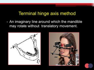 Terminal hinge axis method
• An imaginary line around which the mandible
may rotate without translatory movement.
 