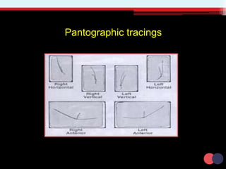 Pantographic tracings
 