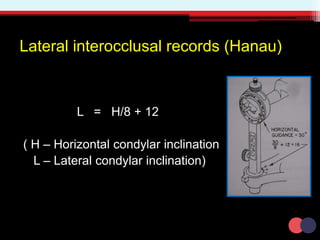 Lateral interocclusal records (Hanau)
L = H/8 + 12
( H – Horizontal condylar inclination
L – Lateral condylar inclination)
 