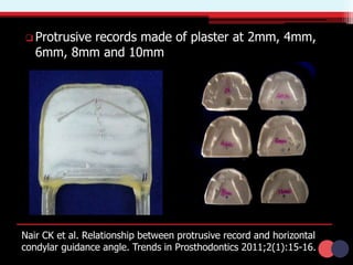  Protrusive records made of plaster at 2mm, 4mm,
6mm, 8mm and 10mm
Nair CK et al. Relationship between protrusive record and horizontal
condylar guidance angle. Trends in Prosthodontics 2011;2(1):15-16.
 