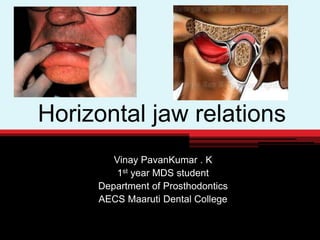Horizontal jaw relations
Vinay PavanKumar . K
1st year MDS student
Department of Prosthodontics
AECS Maaruti Dental College
 