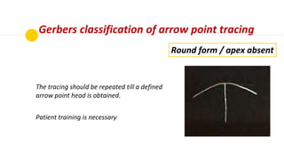 Gerbers classification of arrow point tracing
Similar to typical form, however the extension
of tracing is very limited.
T...